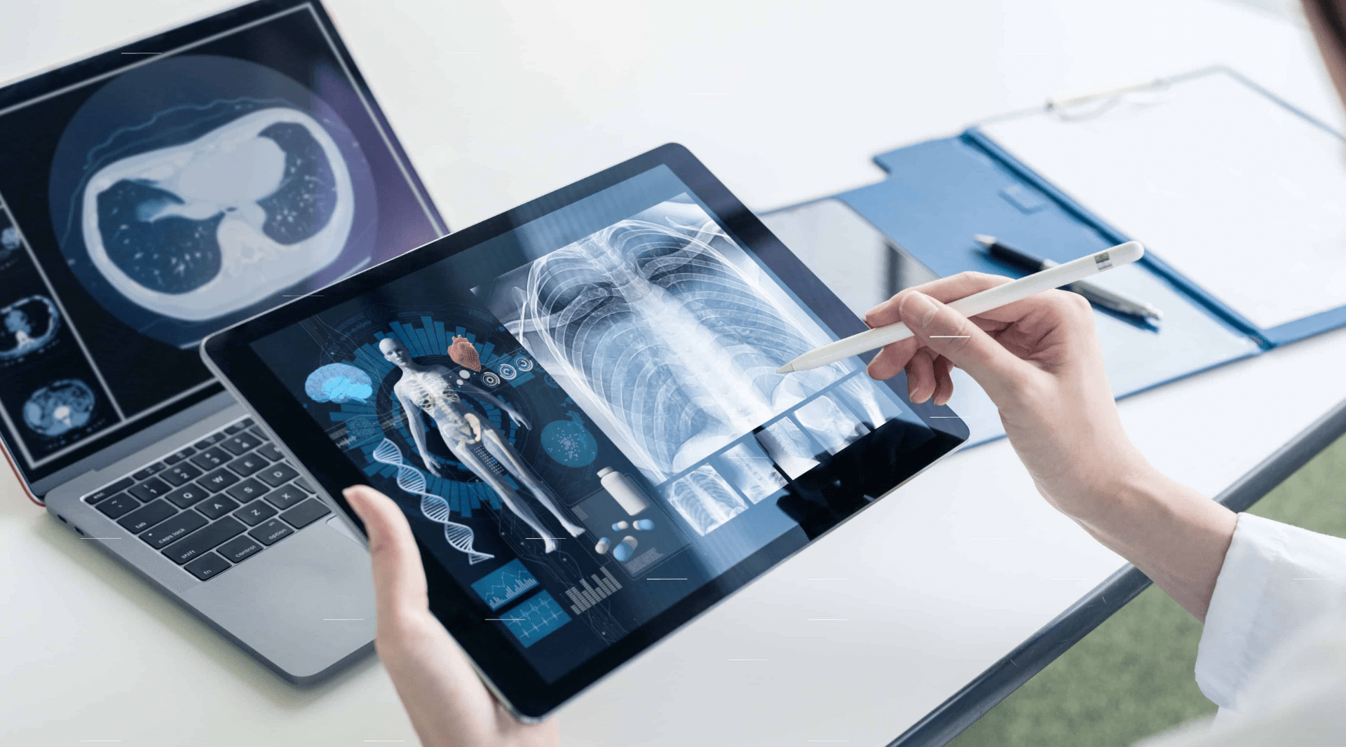 6 tendências que vão revolucionar a prática da telerradiologia e telemedicina