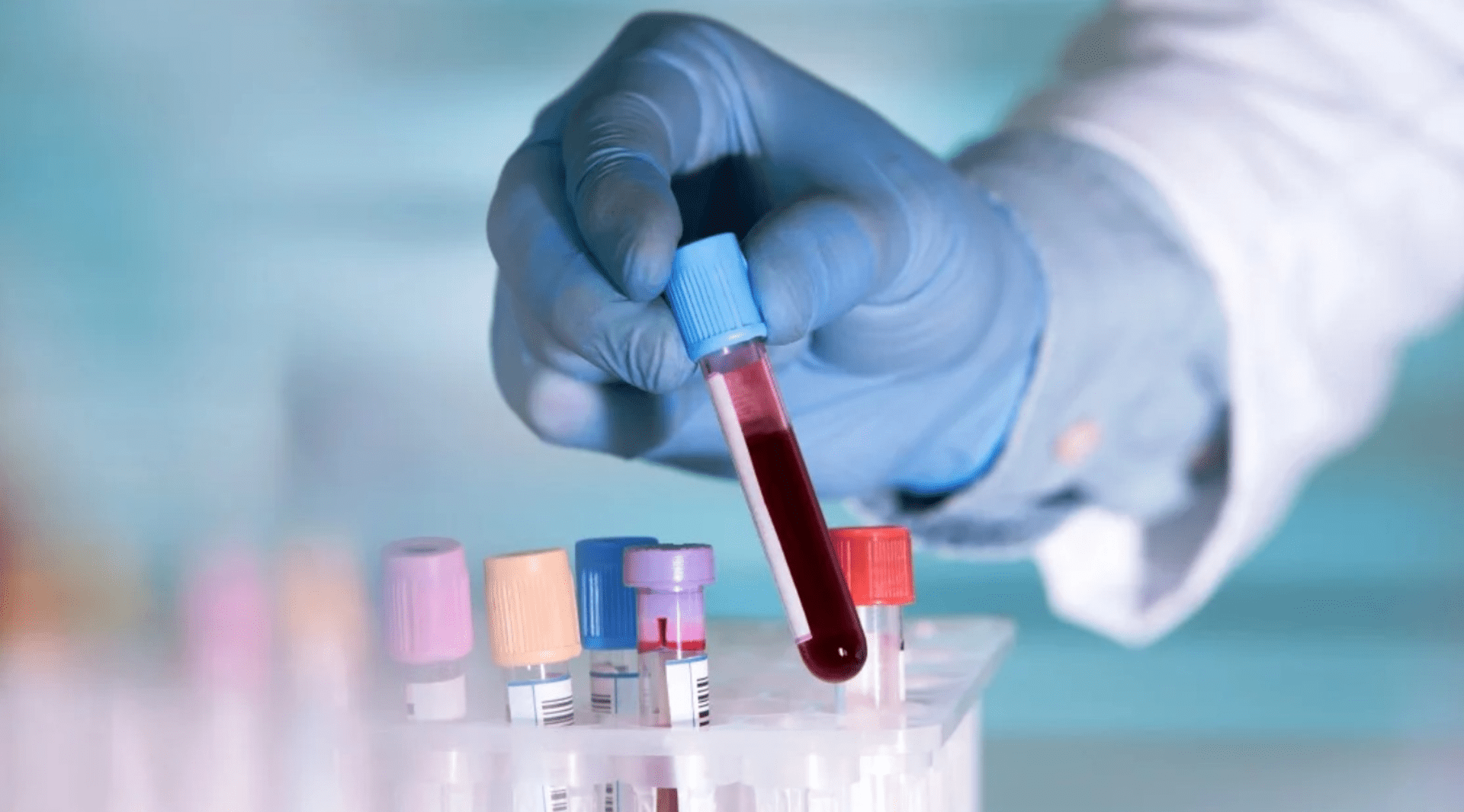Sistemas de gestão elevam padrões em anatomia patológica