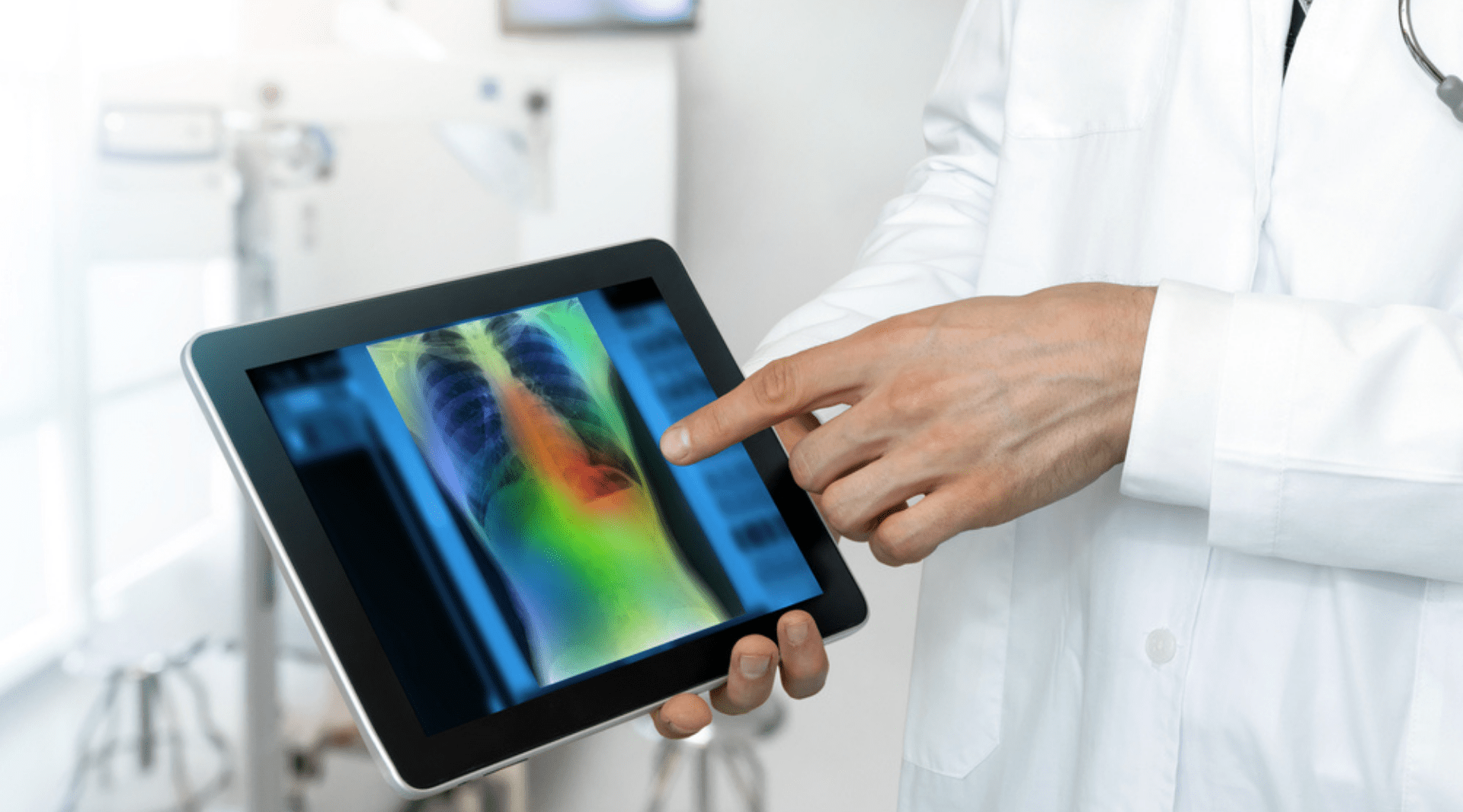 Inteligência artificial no PACS: um reforço para a tomada de decisão clínica