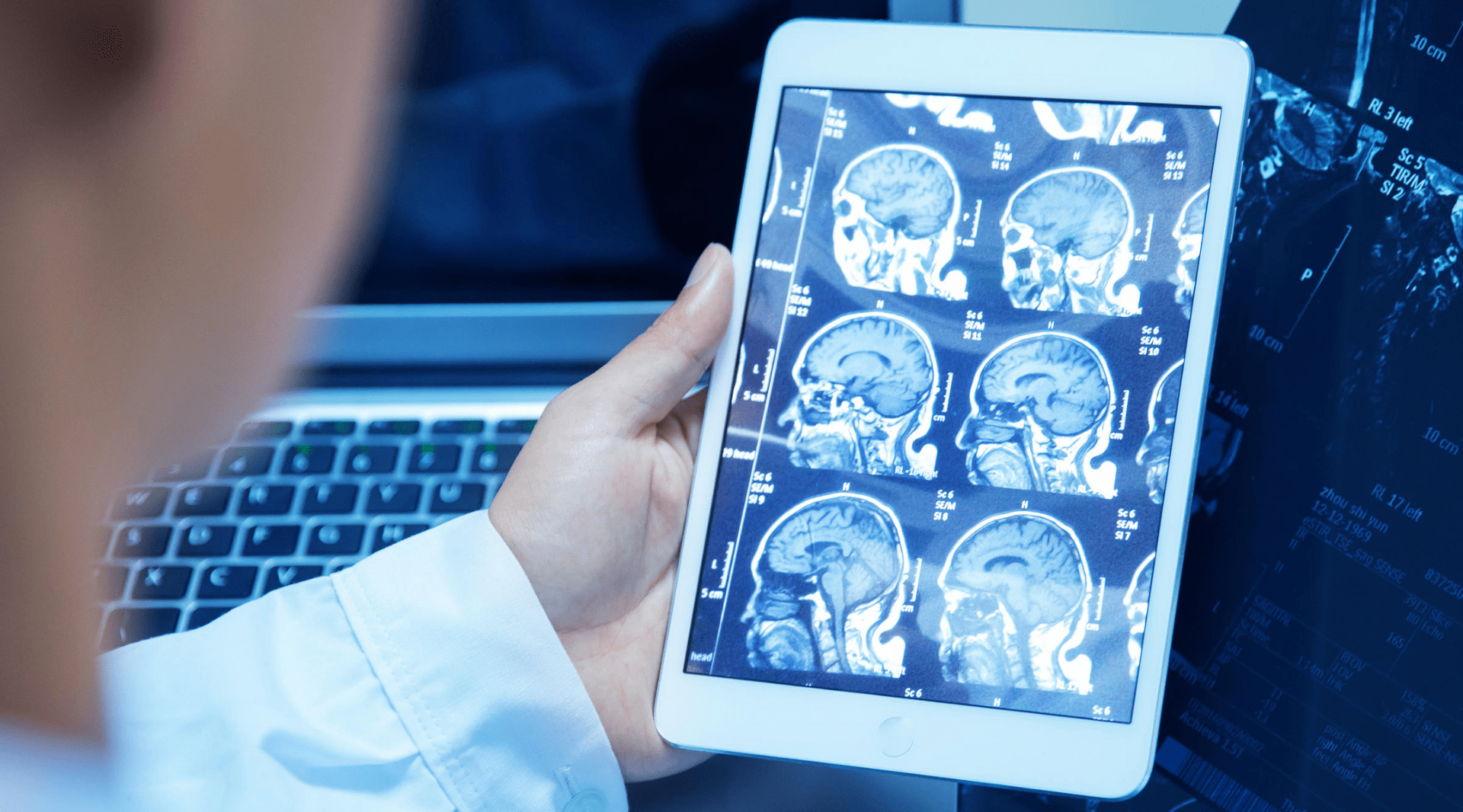 Radiologia brasileira: 6 tendências que chegarão ao mercado