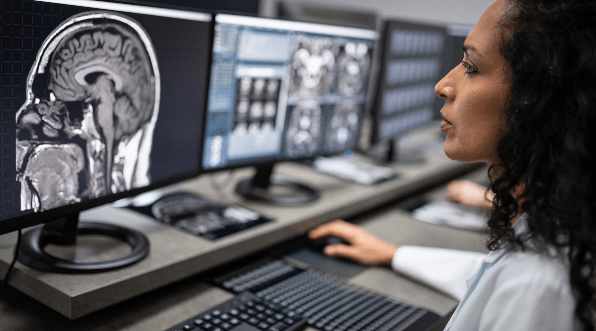 Sistema PACS otimiza a prática da telerradiologia