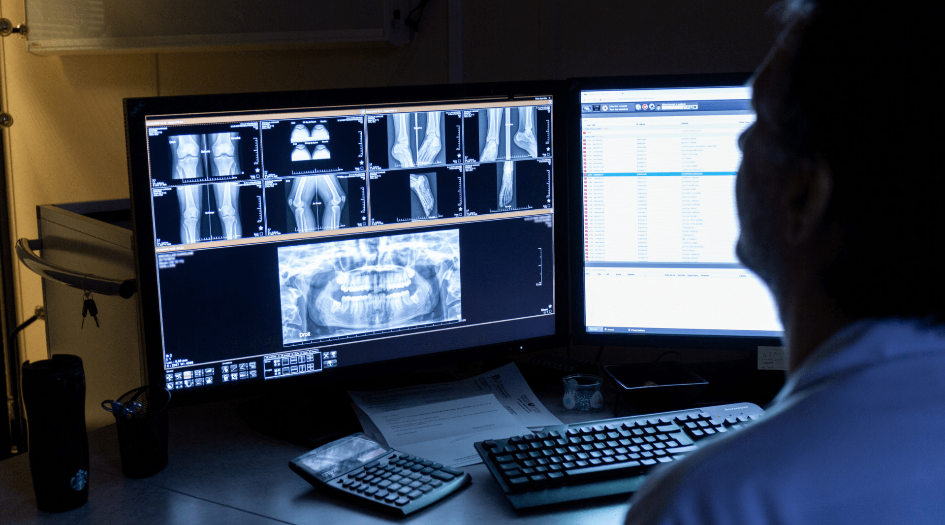 PACS: o impacto do reconhecimento de voz no dia a dia do radiologista