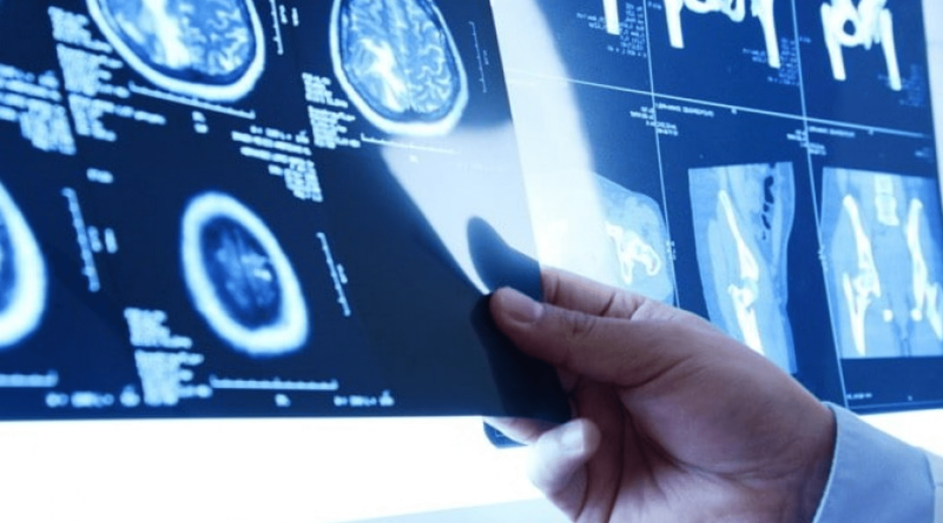 Como o técnico deve se preparar para as novas tecnologias em radiologia?