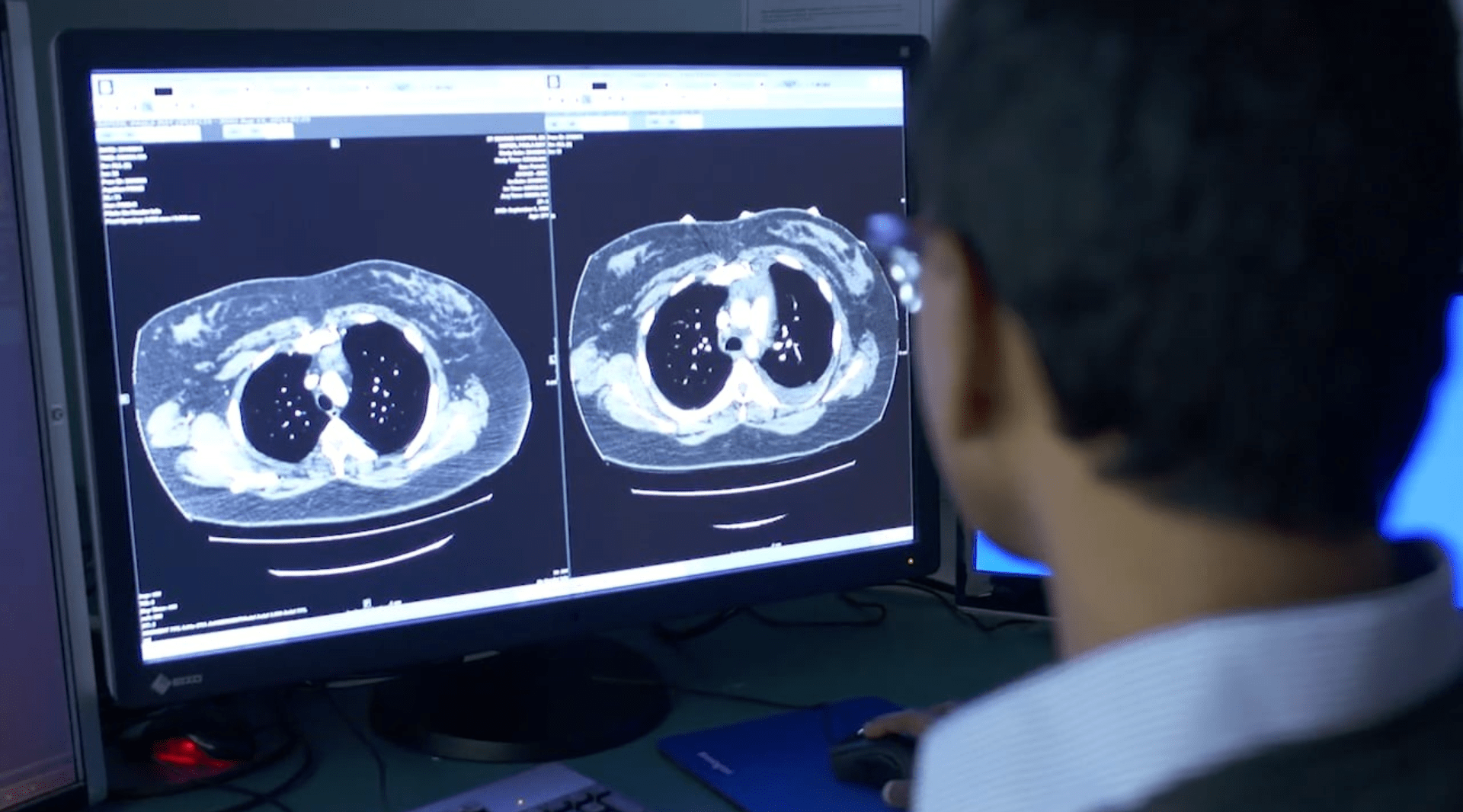 Enterprise Imaging: o que é e os impactos no diagnóstico
