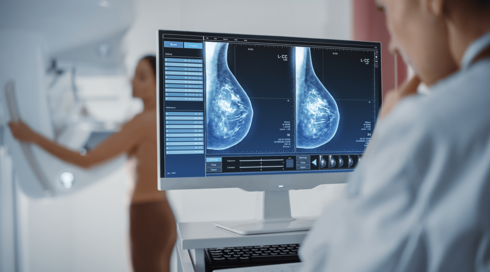 Exame de mamografia: os benefícios dos visualizadores especializados