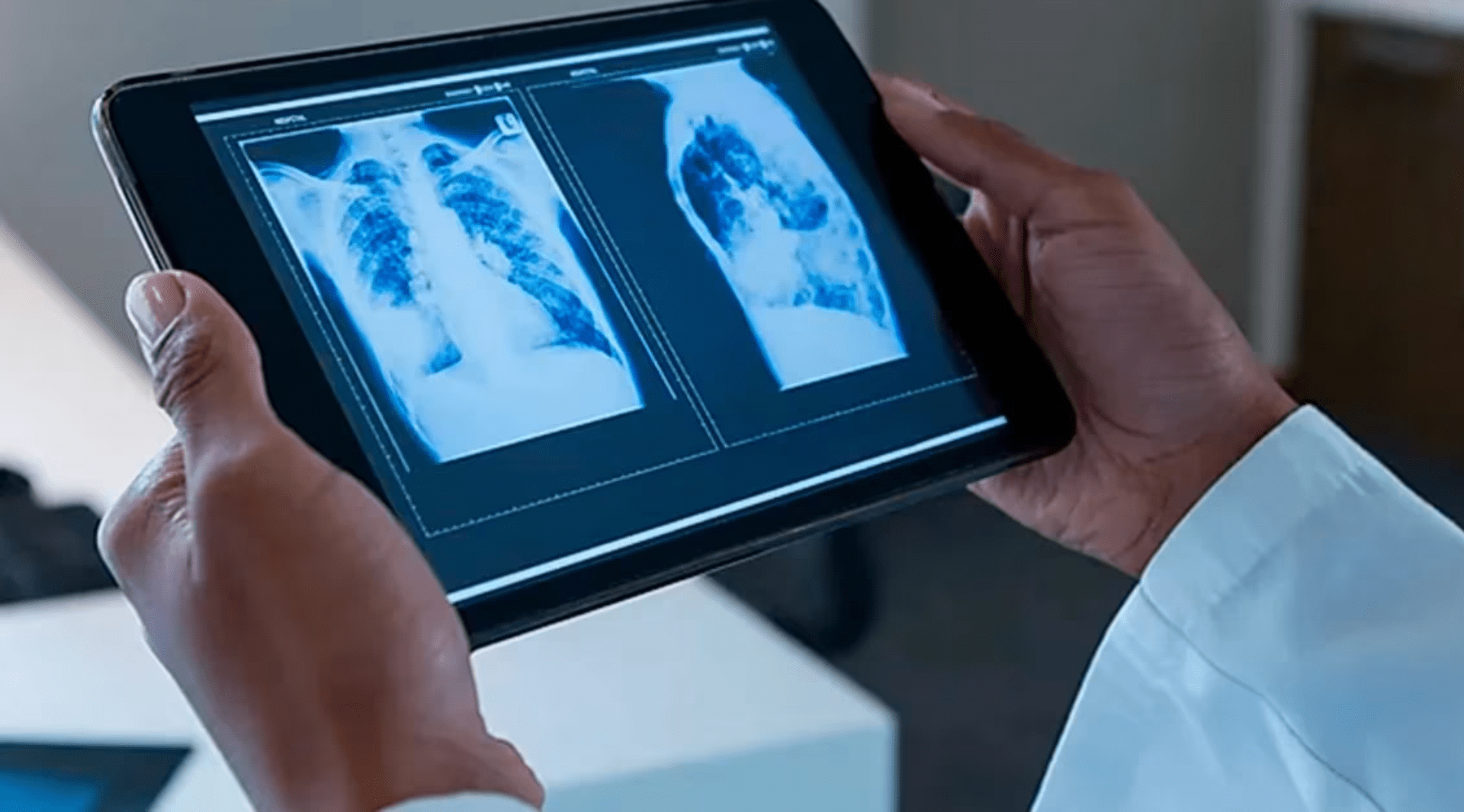 Medicina Diagnóstica: as principais dúvidas sobre radiologia digital