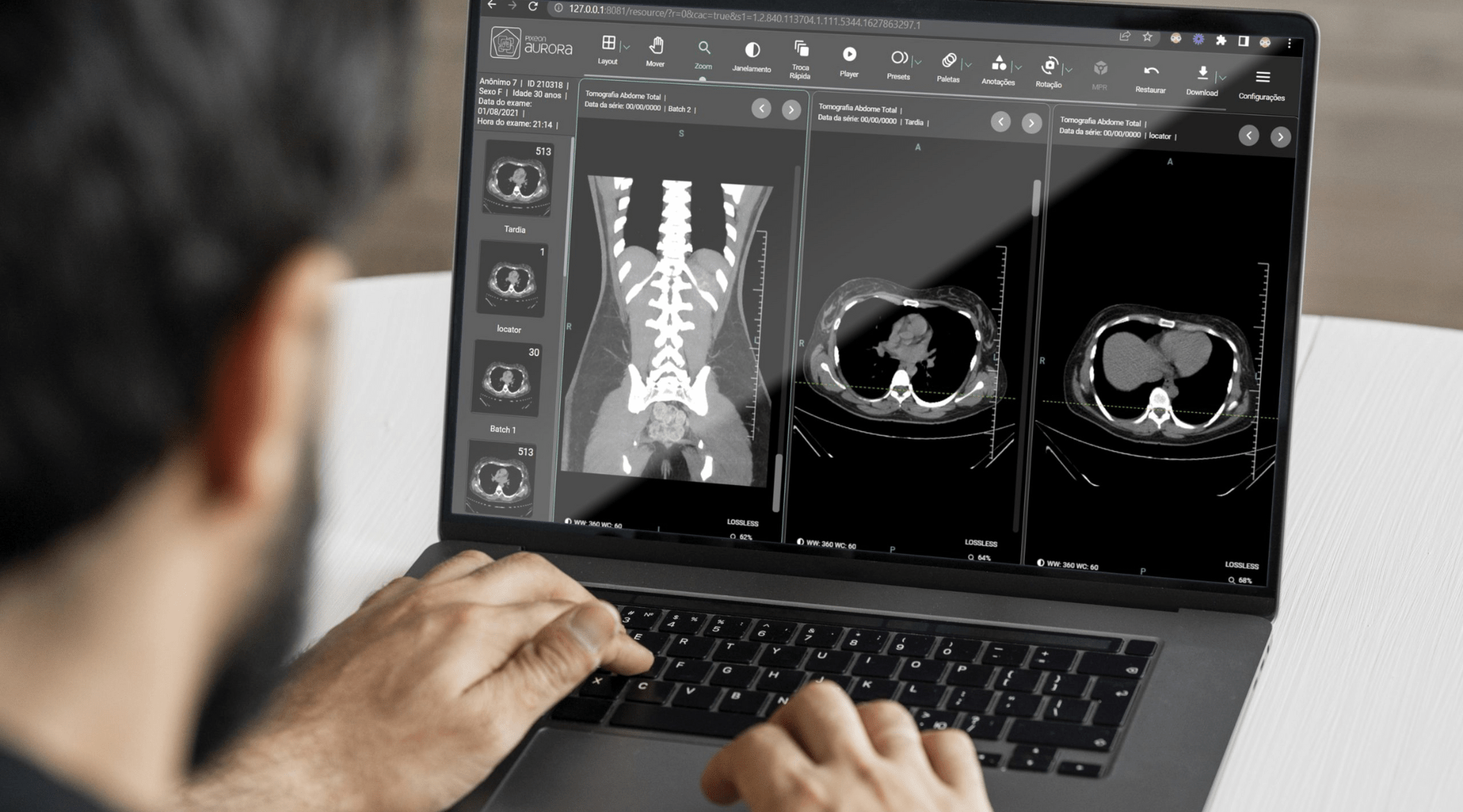 Padrão Dicom e o uso de big data em radiologia digital