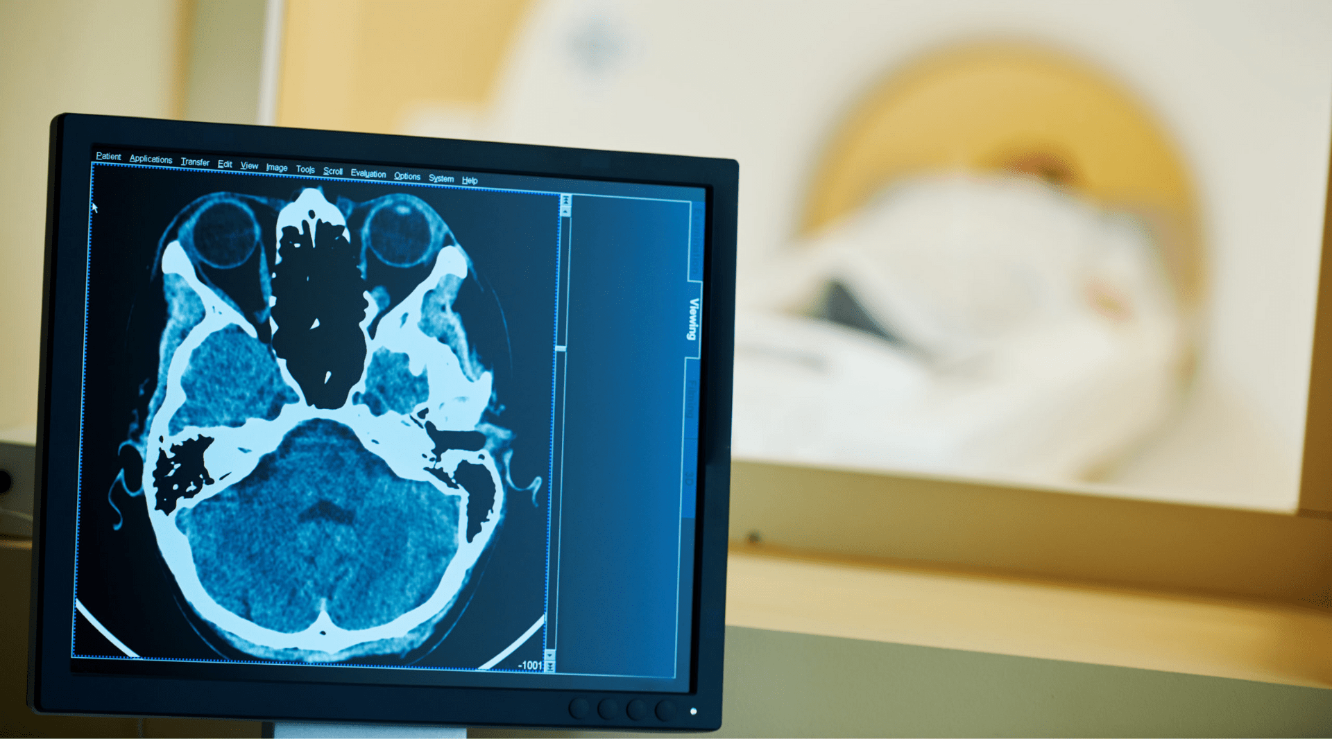 Como a radiologia digital pode auxiliar na medicina diagnóstica