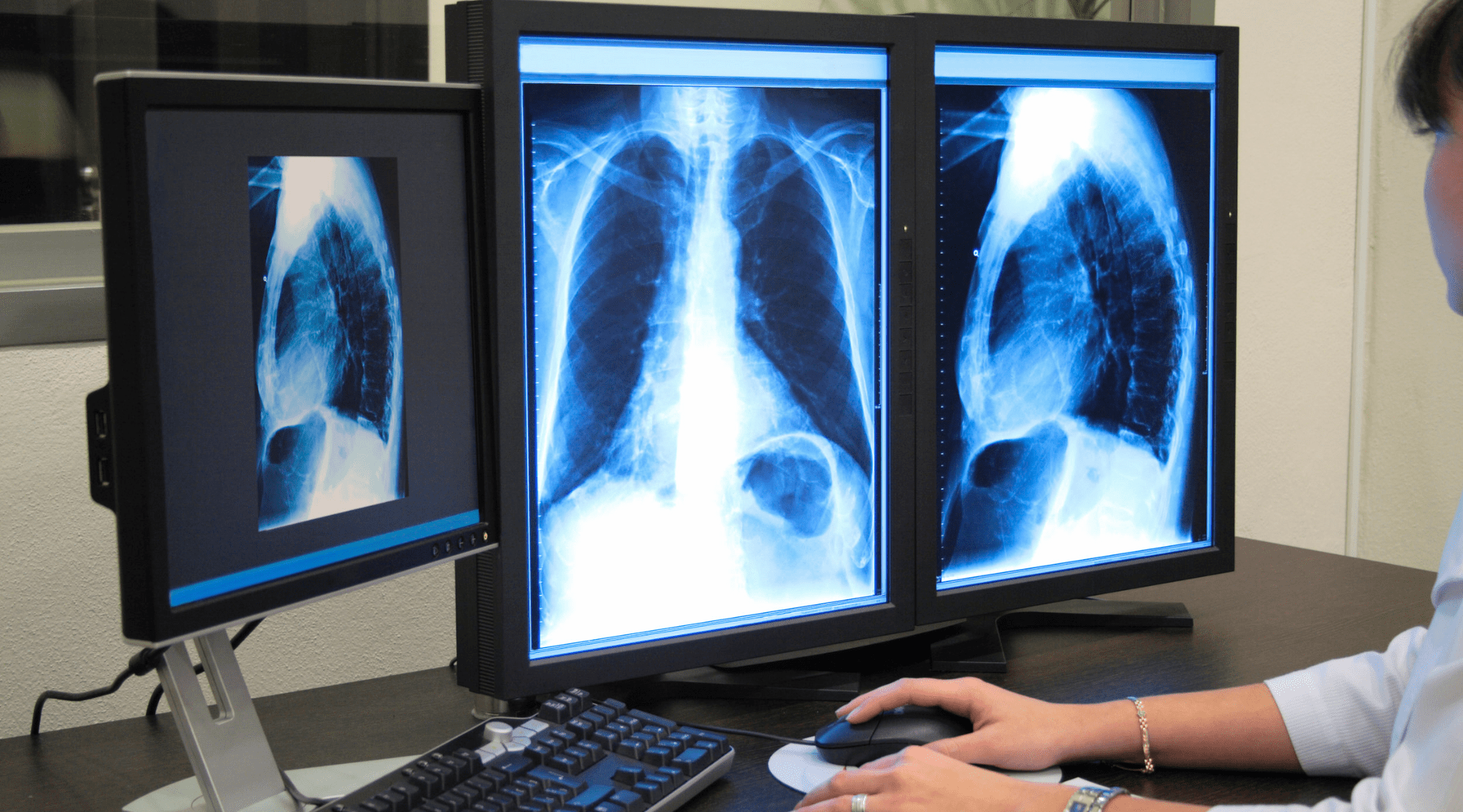 O que você precisa saber antes de optar pela radiologia digital