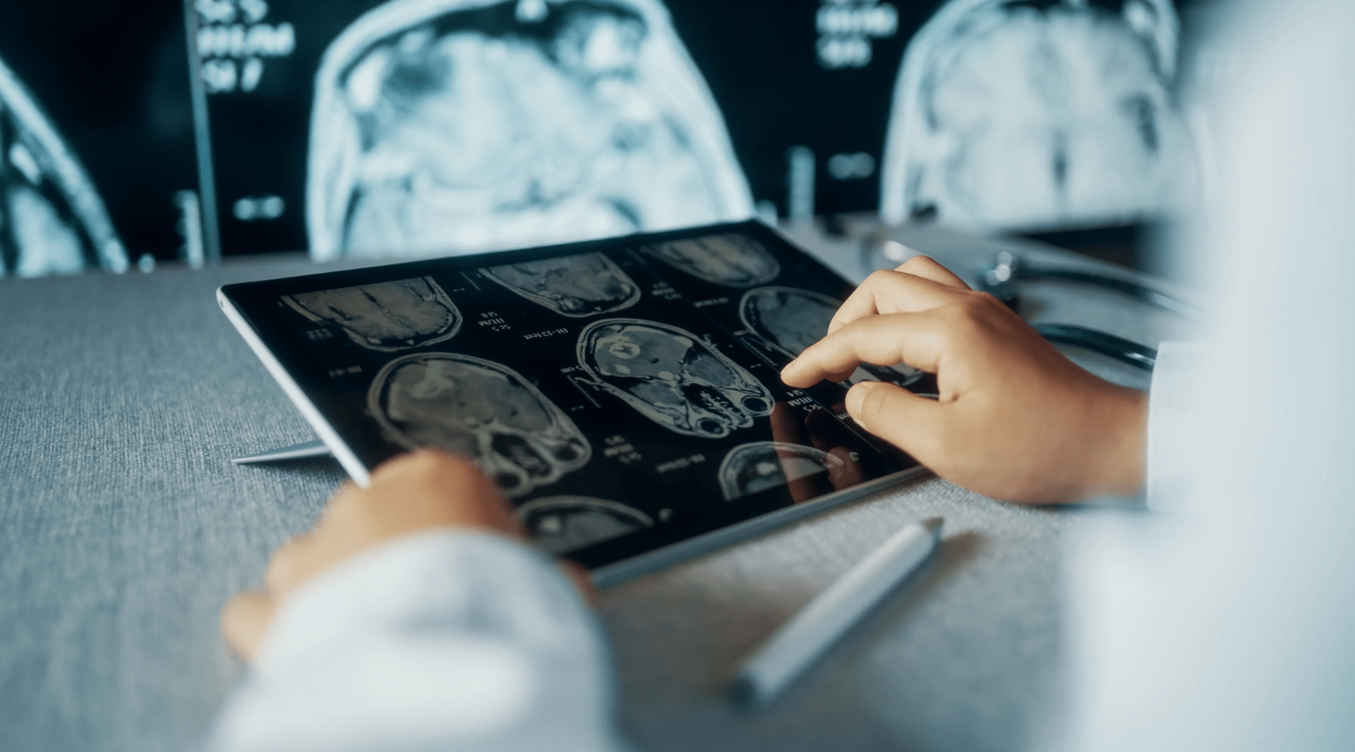 Radiologia Digital: os oito estágios de implantação
